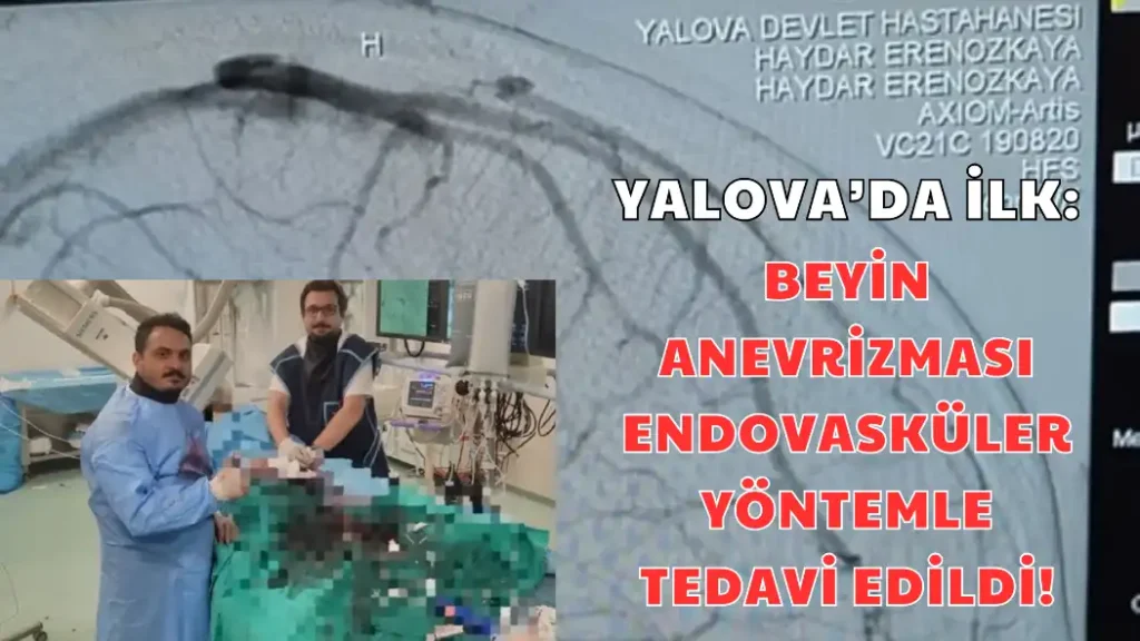Yalova’da İlk Beyin Anevrizması Endovasküler Yöntemle Tedavi Edildi
